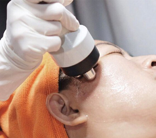 Microdermabrasi, Face Mask, Facial, RF, Mask dari Jes Clinic 1